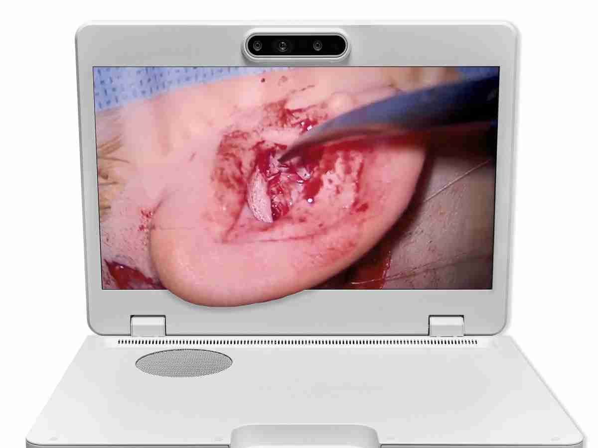 达擎之＂Heads-up 3D显微手术显示系统＂，，，，整合4K裸眼3D显示及眼球追踪系统，，，，具备快速追踪人眼移动位置功能，，，减轻医师长时间维持固定姿势的负担，，，让医师能有更宽广清晰的3D立体视野及更舒适的姿势来执行手术。。。。